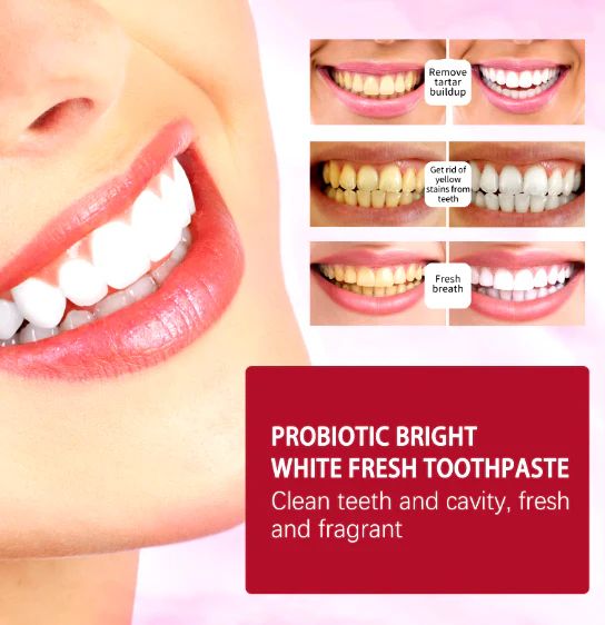 120g Probiotic SP-4 Whitening Toothpaste