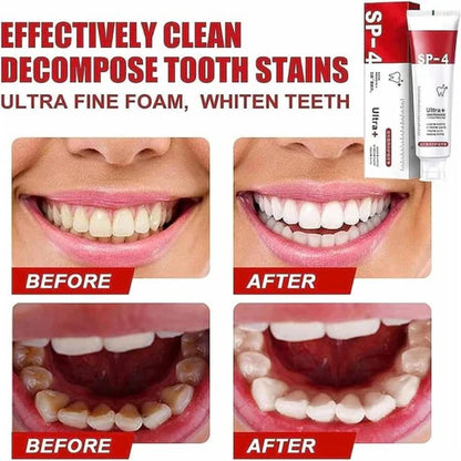 120g Probiotic SP-4 Whitening Toothpaste