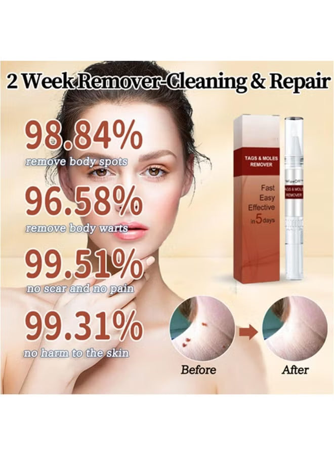Wipe-Off Skin Tag and Mole Remover Pen with Natural Tea Tree Oil for face, neck, and body – gentle and effective home skincare treatment.