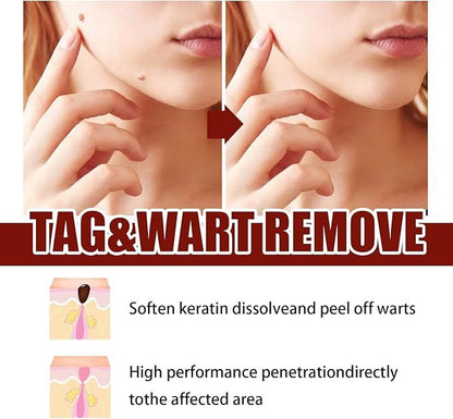 Wipe-Off Skin Tag and Mole Remover Pen with Natural Tea Tree Oil for face, neck, and body – gentle and effective home skincare treatment.