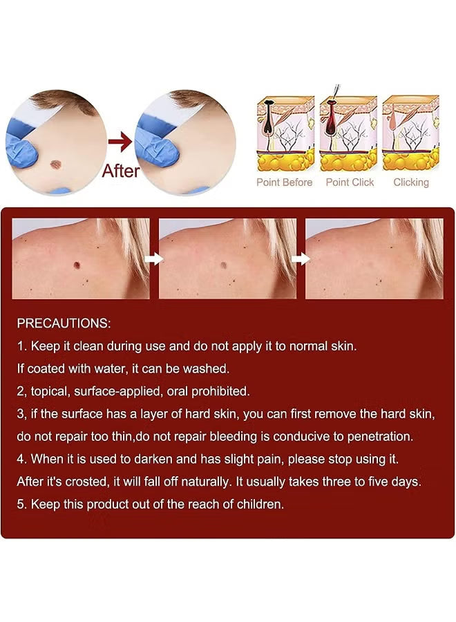 Wipe-Off Skin Tag and Mole Remover Pen with Natural Tea Tree Oil for face, neck, and body – gentle and effective home skincare treatment.