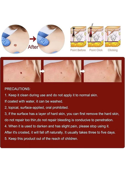 Wipe-Off Skin Tag and Mole Remover Pen with Natural Tea Tree Oil for face, neck, and body – gentle and effective home skincare treatment.