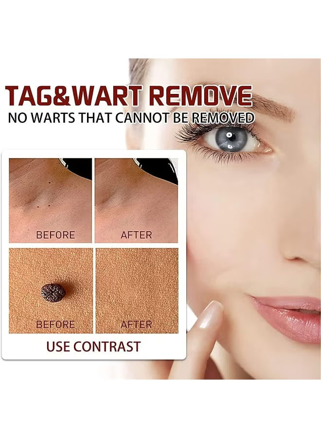 Wipe-Off Skin Tag and Mole Remover Pen with Natural Tea Tree Oil for face, neck, and body – gentle and effective home skincare treatment.