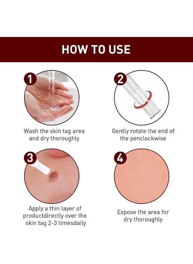 Wipe-Off Skin Tag and Mole Remover Pen with Natural Tea Tree Oil for face, neck, and body – gentle and effective home skincare treatment.