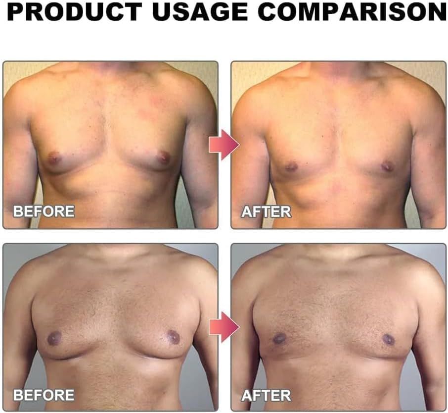 15ml Gynecomastia Tightening Oil for Men 