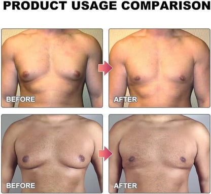 15ml Gynecomastia Tightening Oil for Men 