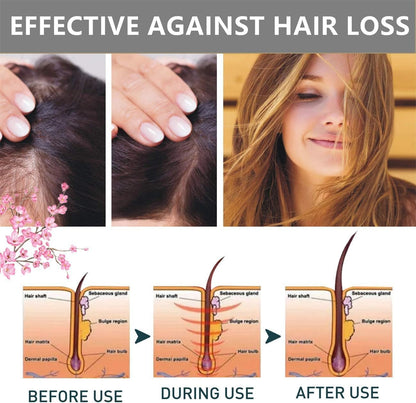 Sakura Japanese Shampoo For Hair Loss